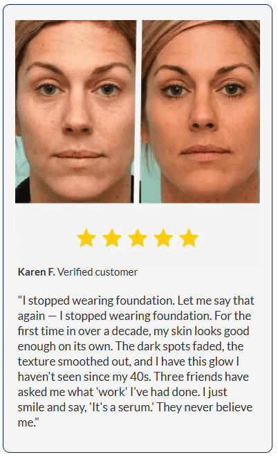 Before and after results showing smoother, firmer-looking skin using Luminara Rewind anti-aging serum.